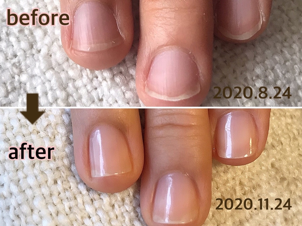 自爪育成ネイルケア