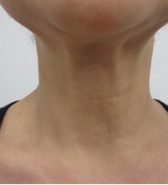 【急募】45歳以上で首の老化が気になる方　港区グリーンピール認定サロンお顔が若々しくても首が原因で老けて見えることもあります