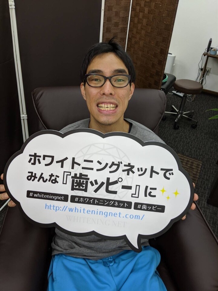 セルフホワイトニング体験できます😄