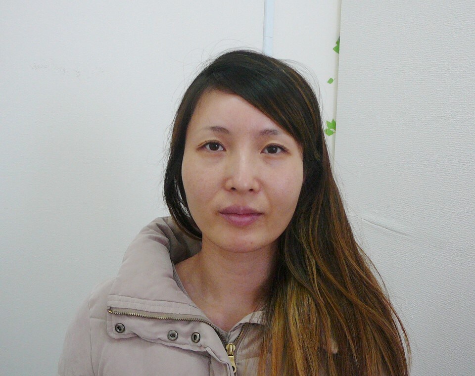 顔歪み改善コース　ビフォーアフター写真