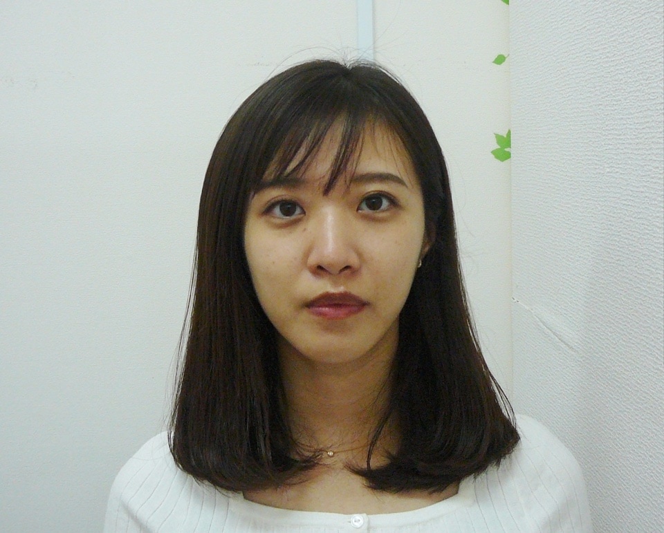 顔歪み矯正コース　ビフォーアフター写真　8回目