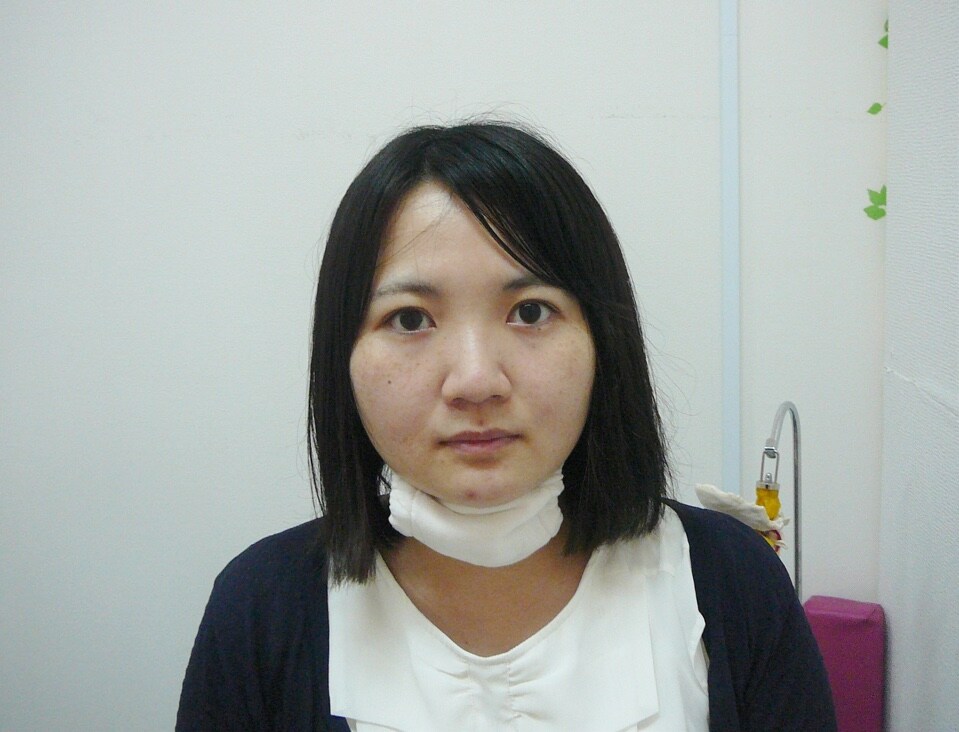 顔歪み矯正コースでこんなに変わりました