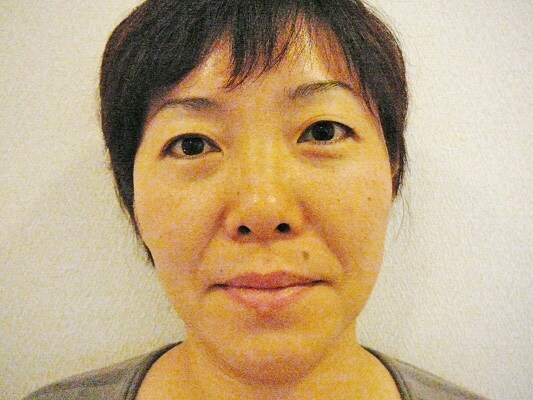 お顔の歪みとほうれい線がスッキリしました