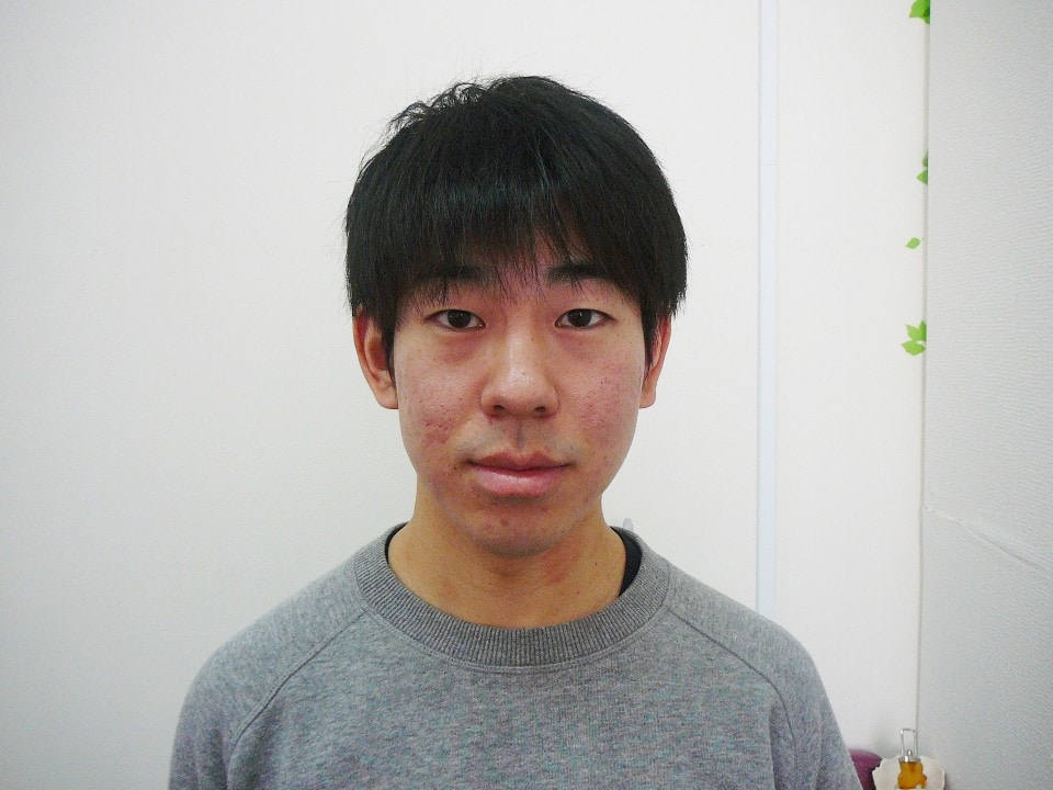 顔歪みで悩んでいました