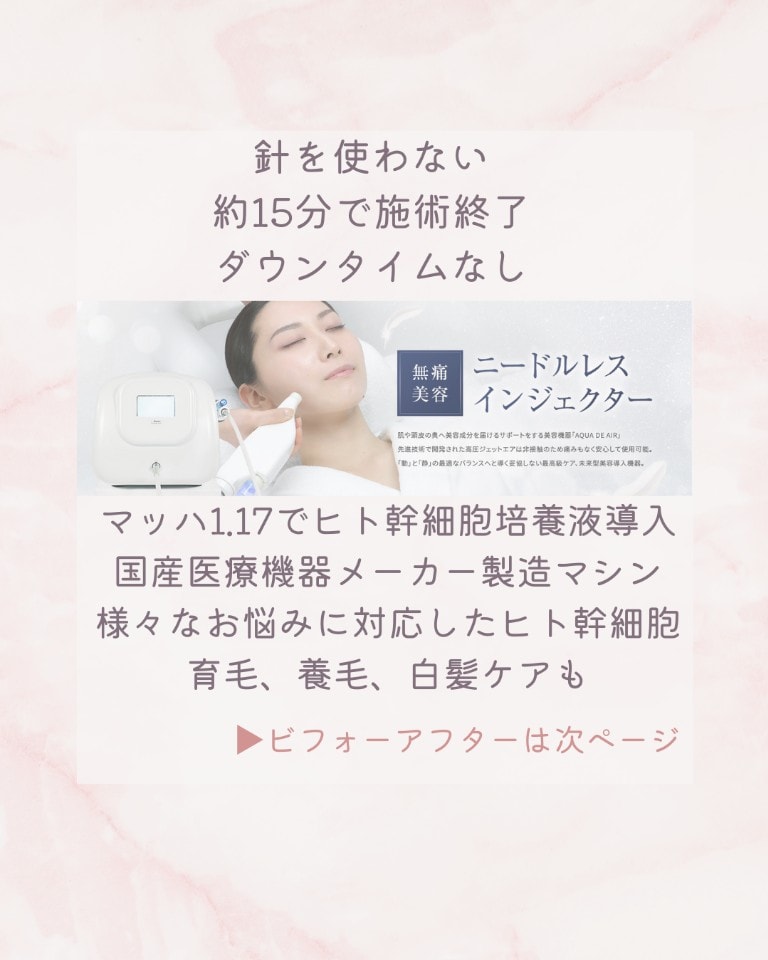 無痛美容　ニードルレスインジェクター アクアドエア