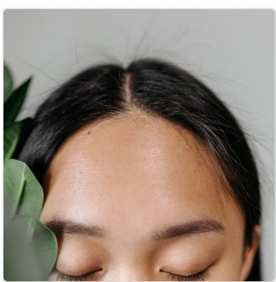 筋膜リリース「前頭筋」