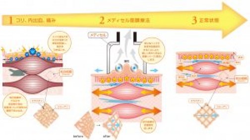 背中や腰が冷たい方の特徴
