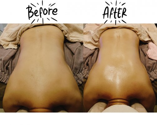 筋膜リリース×アロマ施術での結果