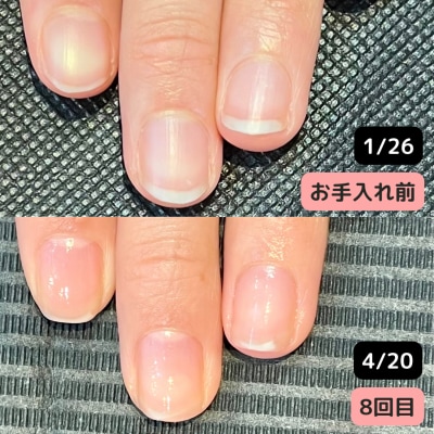 【現金支払いのみ】(全8回）最強のネイルケアコース