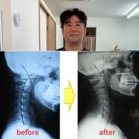 カイロプラクティック整体 モリ　｜福岡県太宰府市  西鉄五条駅から徒歩 1分｜