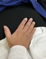 兵庫県西宮市/東接骨院/併設整体院/江崎整体