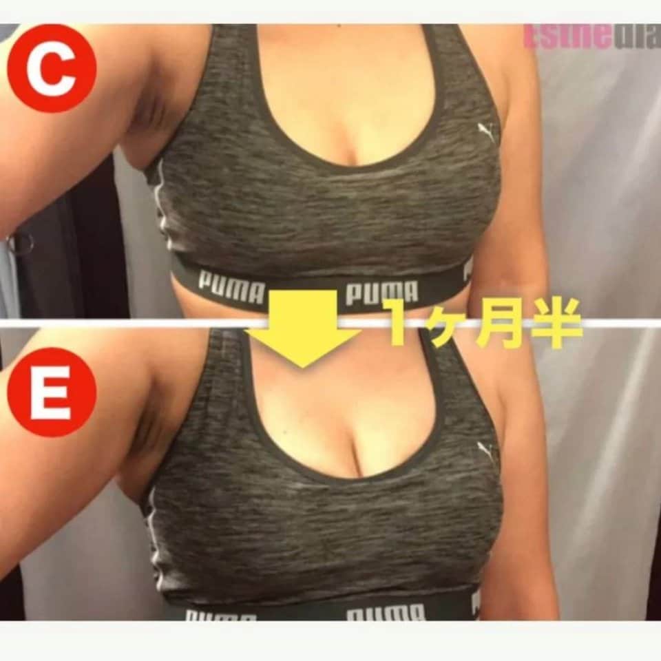 バストアップ大牟田バストケア