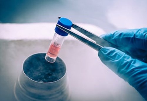 EXOプレミアム幹細胞エキス療法