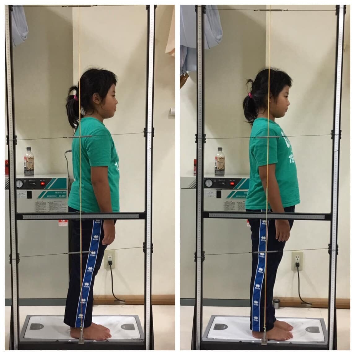 コアシンクEMSコースのご案内 愛媛県西予市 おかだ整骨院・整体院 捻挫、肉離れ、オスグッドなどスポーツ障害ならお任せください。腰痛、肩凝り、自律神経治療もご相談ください。交通事故治療専門院。