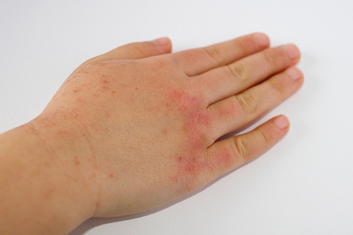 さくら鍼灸整骨院