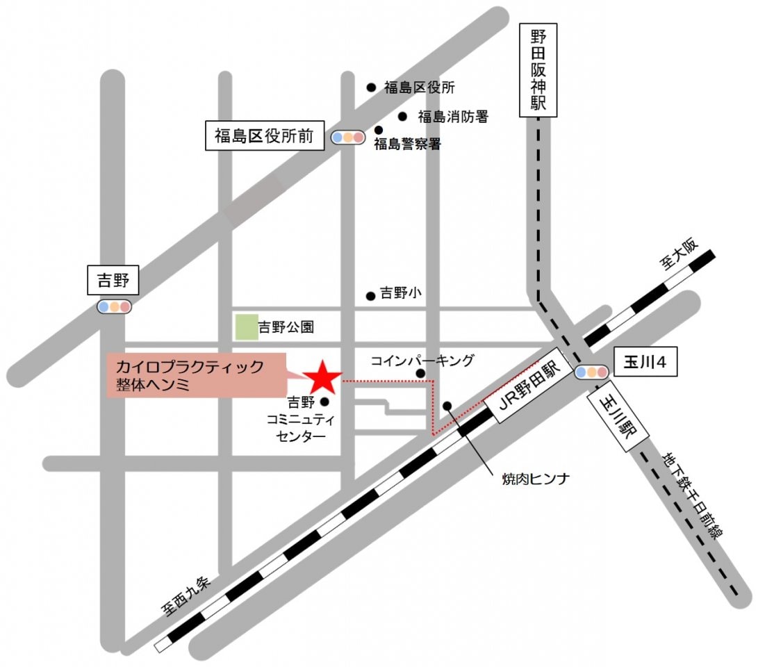 大阪市福島区のストレートネック、骨盤矯正専門のカイロプラクティック整体ヘンミ　首の痛み、肩こり、手のシビレ、腰痛、坐骨神経痛、頭痛、めまい、頚椎症、自律神経失調症でお悩みの方は当院にお任せください。