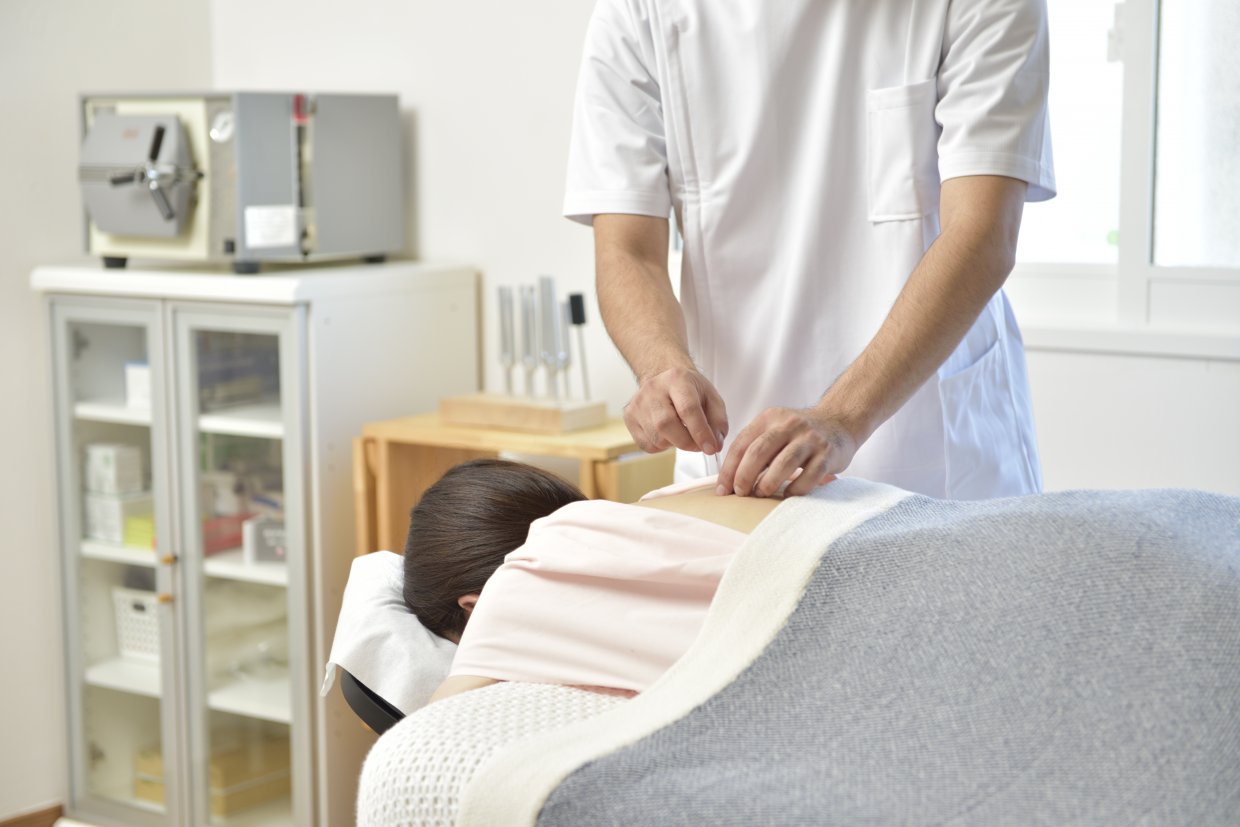 鍼灸治療中の写真