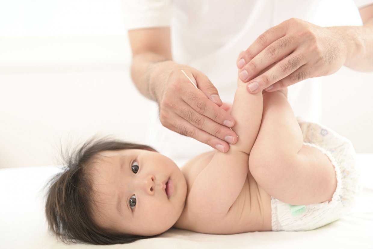 小児鍼施術中写真