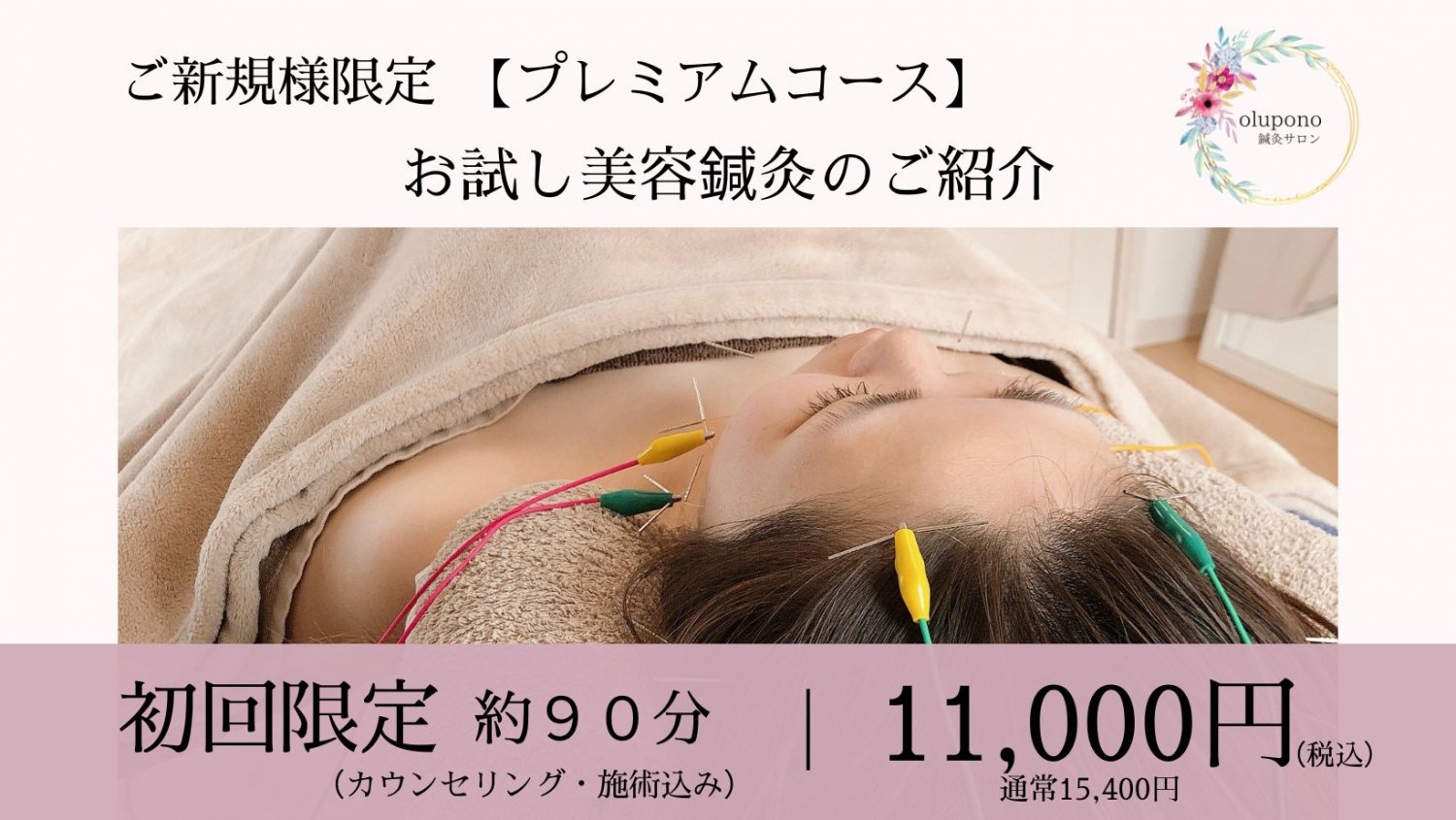 千葉市　JR都賀駅　美容鍼灸　美容鍼　鍼灸治療　ダイエット