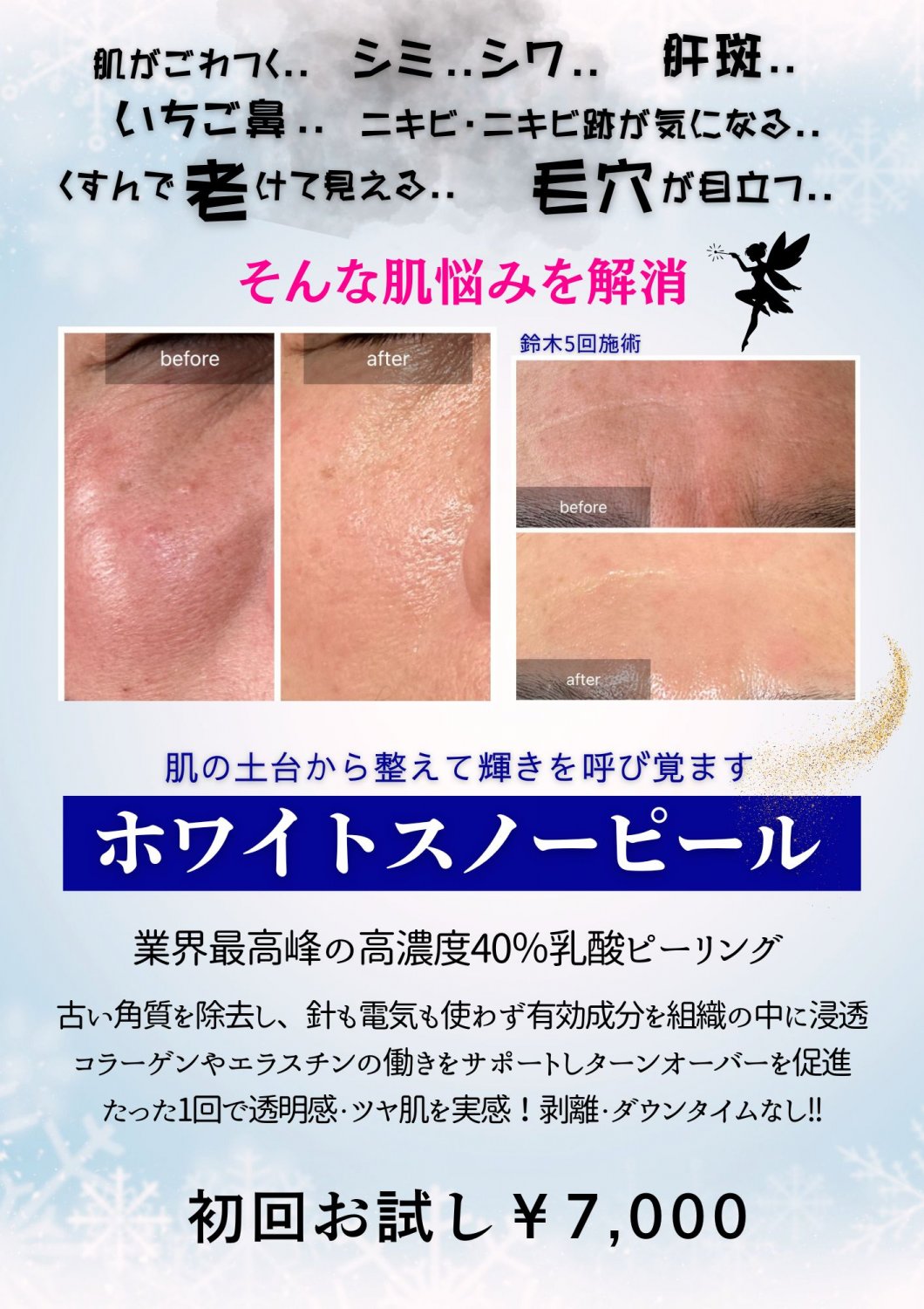 ホワイトスノーピールお試し￥7,000