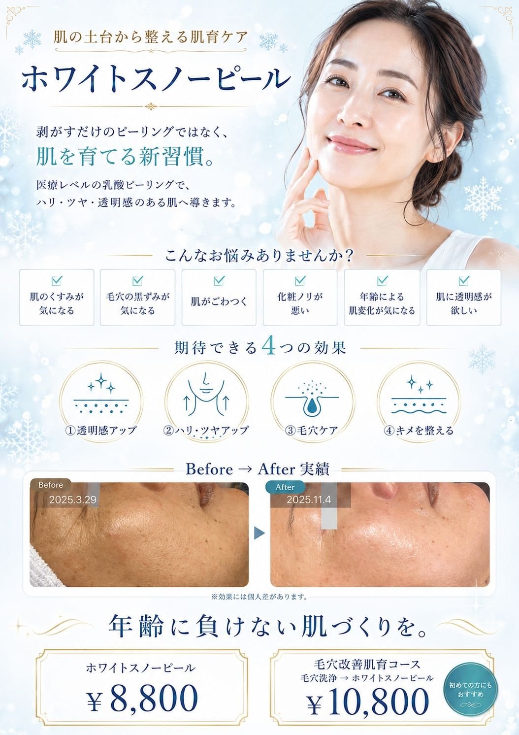 ホワイトスノーピール