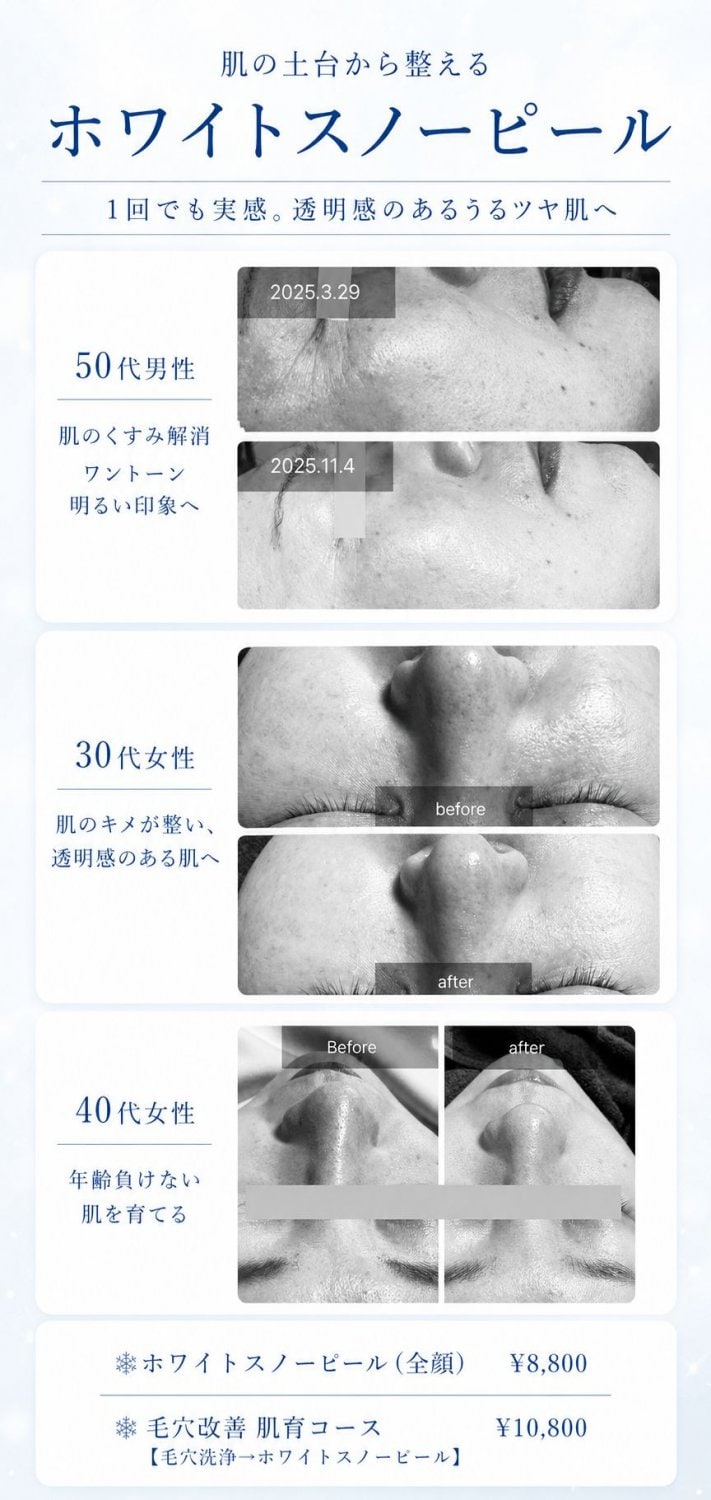 ホワイトスノーピール　before＆after