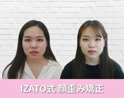ここまで変わる小顔矯正