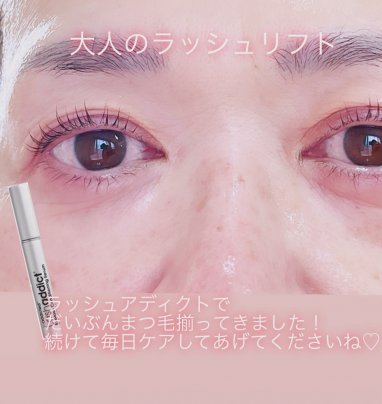 大人のラッシュリフト