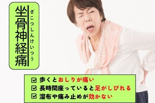 腰周りダイエット【骨盤の歪み】×【坐骨神経痛】なぜ？！繰り返すの？！ 再発してしまう方、なかなか改善しない方