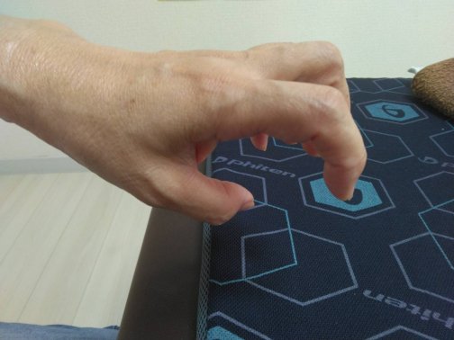 腱鞘炎・手首の痛みを根本から改善｜働く女性に多い慢性不調