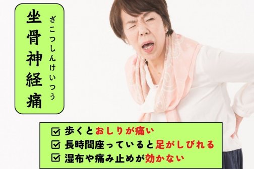🍂更年期と自律神経の乱れが関係？この時期に増える女性の坐骨神経痛🍂