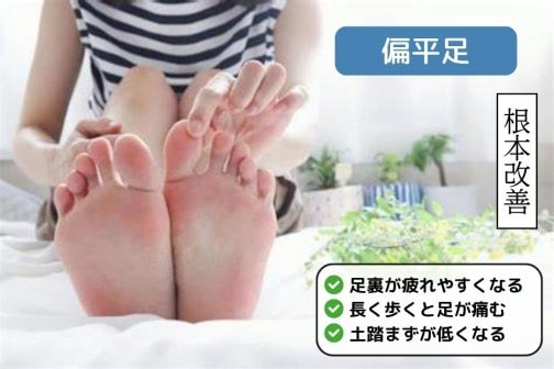 歩くと足裏が疲れる…偏平足と自律神経の乱れが原因かも？
