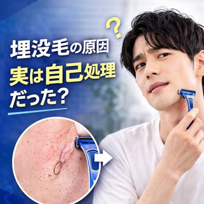 埋没毛の原因、実は自己処理だった？