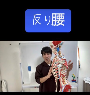 悩んでる方、必見！反り腰について。