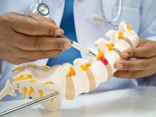 脊柱管狭窄症＝痛みの原因？実は違うケースが多い理由