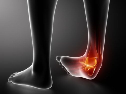 捻挫して歩ける＝軽症？見逃し厳禁な痛みの判断基準