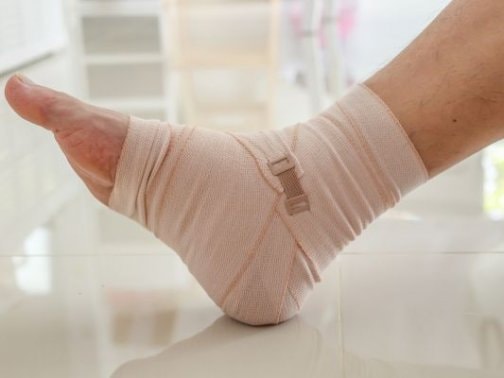 捻挫後の腫れ、いつまで続く？正しい対処法を理学療法士が解説