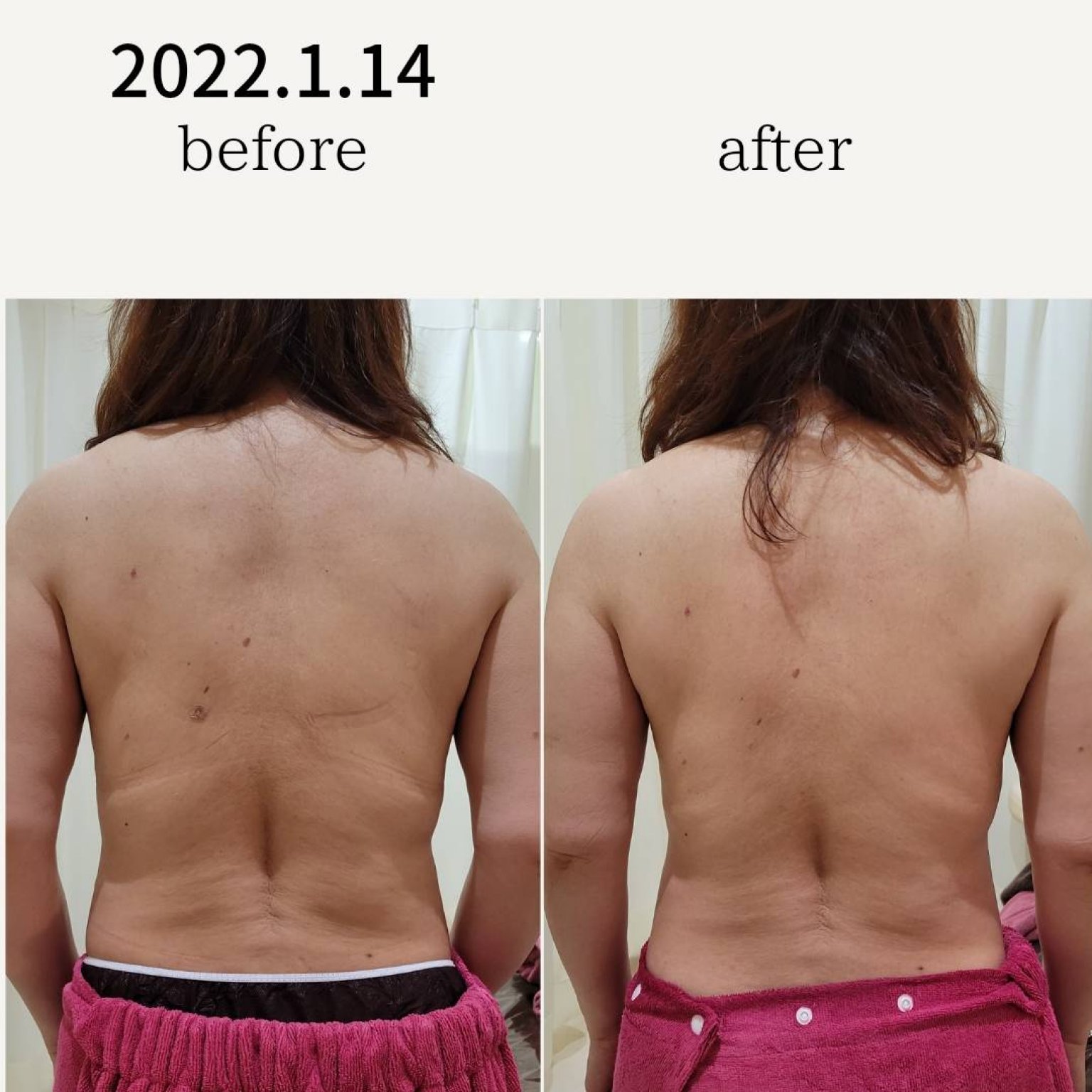 2月8日(日)開運！最強のくびれメイク＆バストアップコース！自分をもっと好きになる、服を着るのが楽しくなる!!あなたも憧れの峰不二子ボディに！夢叶うコラボイベント♡初回限定施術1回チケット/130分｜東京都江東区