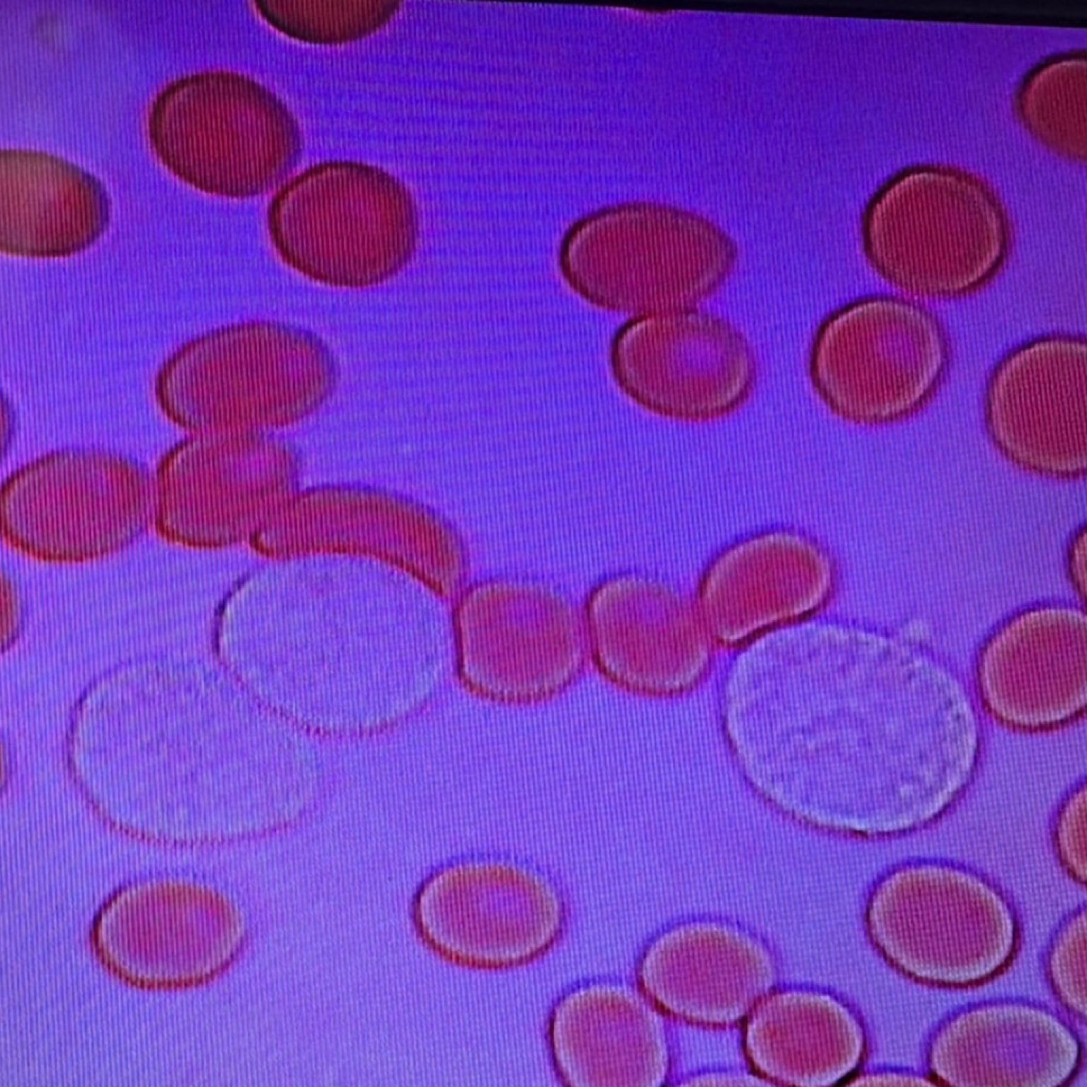 血管ケアの「血液観察会」