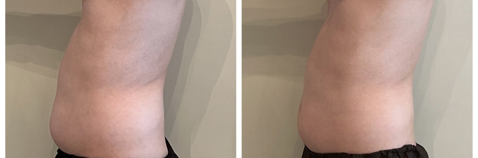 120分マイナス１０㎝ダイエット！リンパデトックス