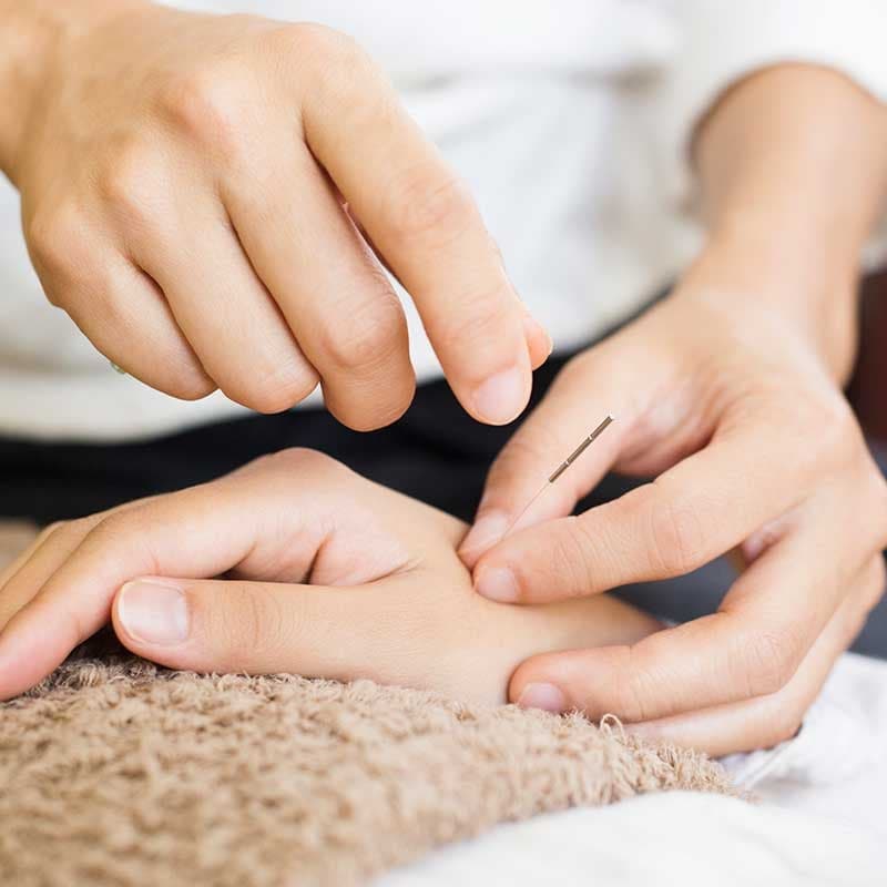 鍼灸