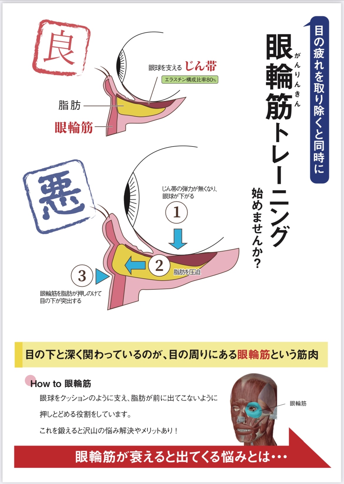 眼輪筋トレーニング機器 ーキャッチアイー