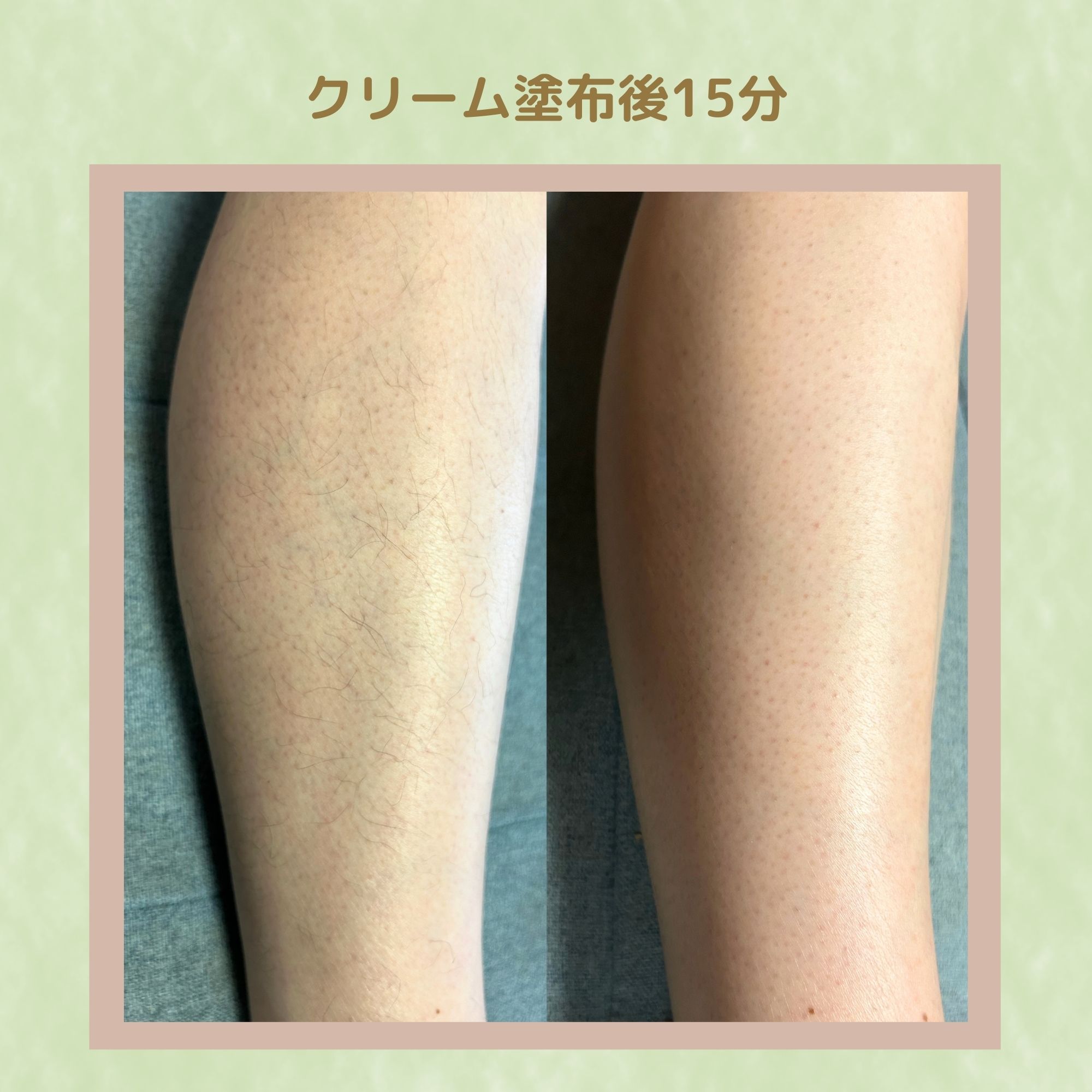 パイナップル豆乳除毛クリーム