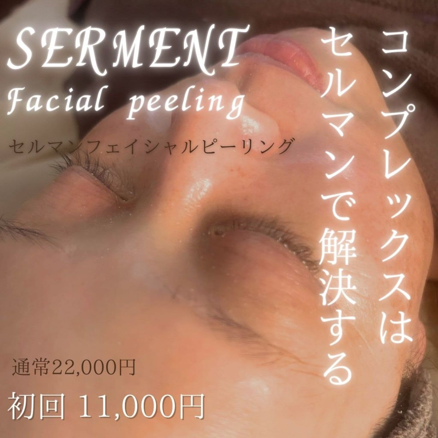 初回限定|セルマンピーリング|【剥かないピーリング】で感動の美肌へ！