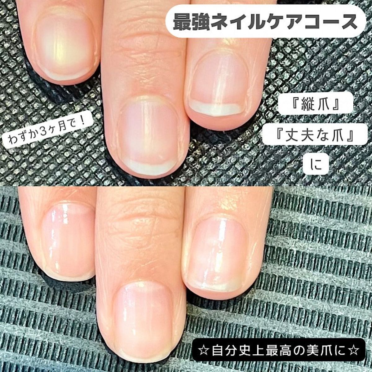 現金特価⭐︎(全8回) 最強ネイルケアコース