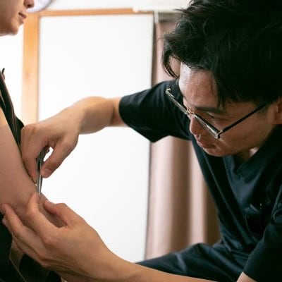 皮内鍼治療(ツクツク限定)