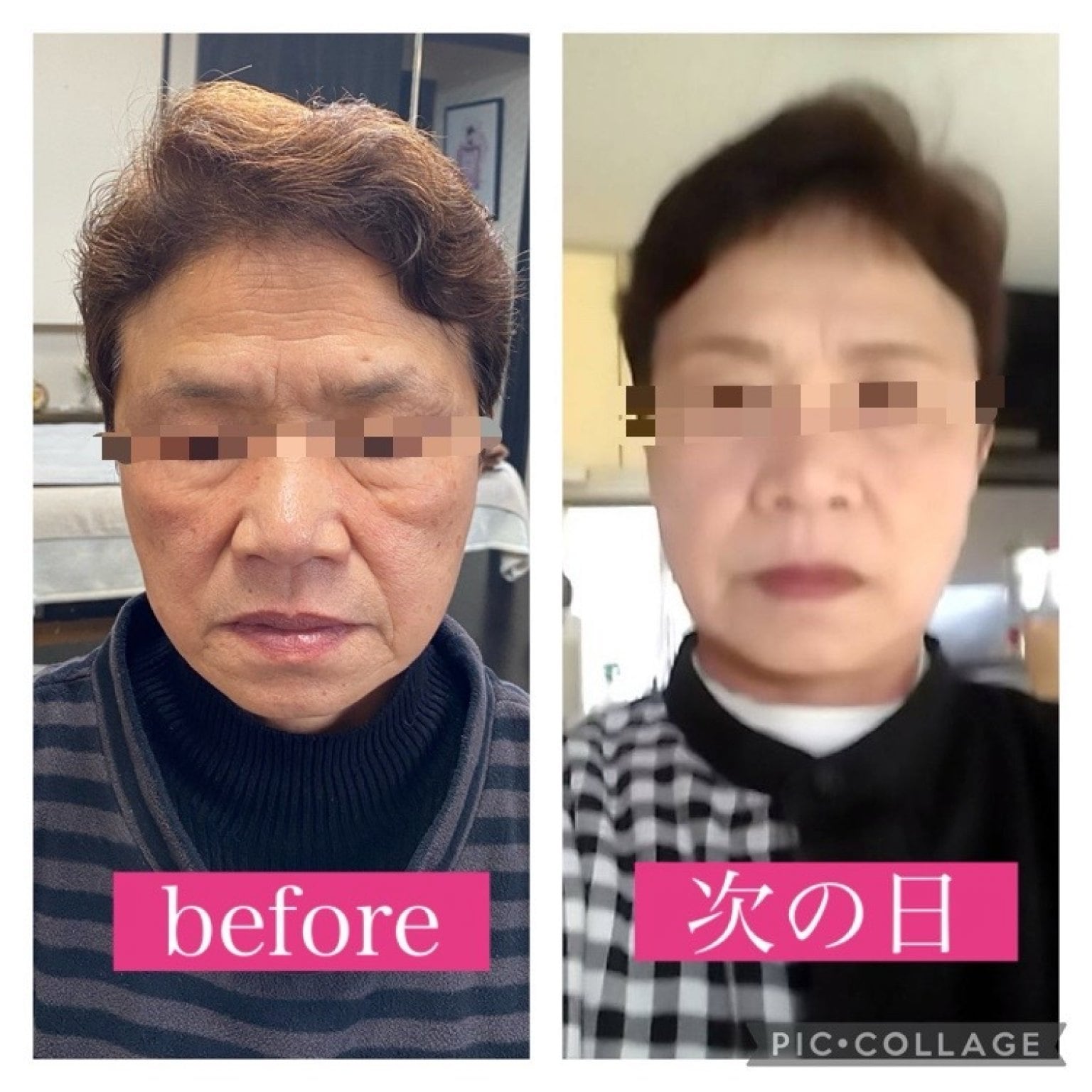 　驚愕！嘘みたい！翌日スッキリ若返る　魔法みたいに顔が美しく整う60分　　小顔骨格美顔セラピー　和歌山/田辺/上富田