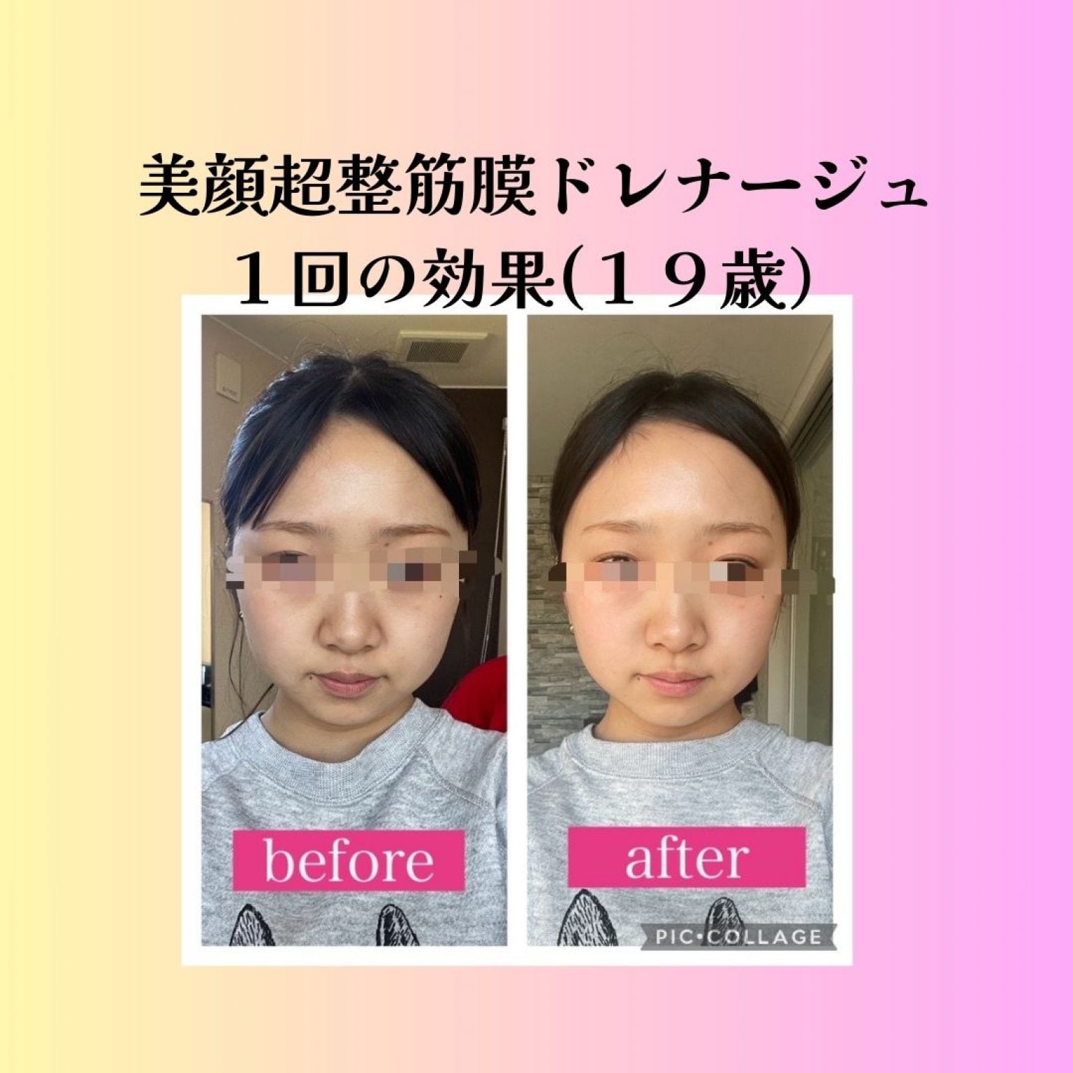 小顔骨格美顔超整セラピー筋膜ドレナージュ肌質改善トリートメントつき(6回数券）