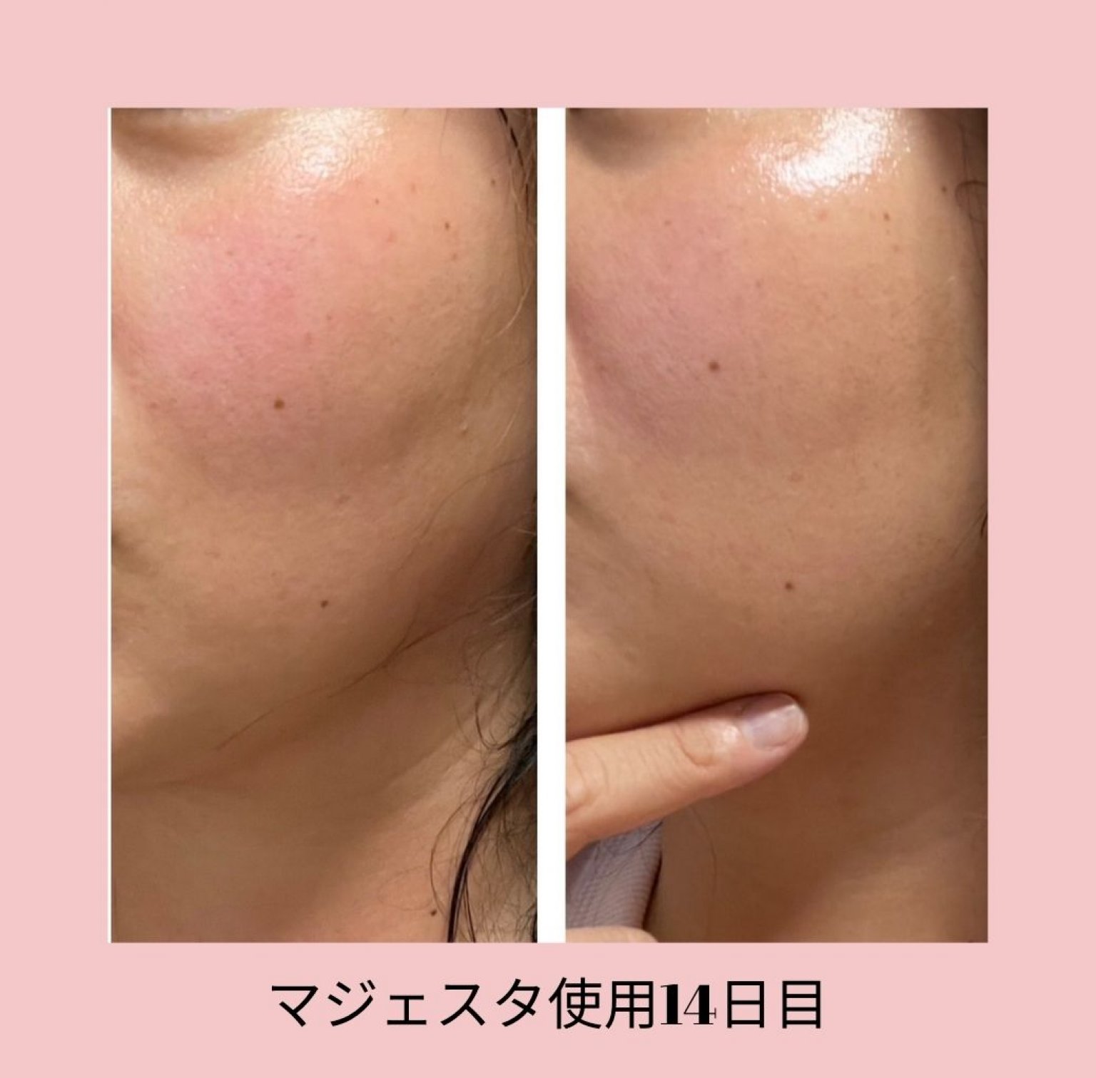 『肌きれいになりたい方入門』たった28日間で自慢の素肌になる　美肌体験モニターオンラインLQコース