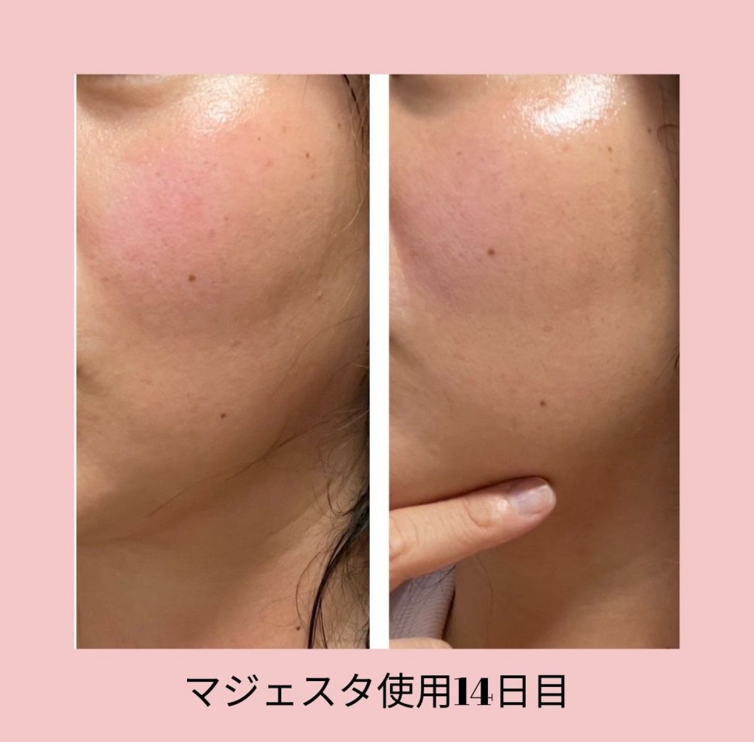 　驚愕！嘘みたい！翌日スッキリ若返る　魔法みたいに顔が美しく整う60分　　小顔骨格美顔セラピー　和歌山/田辺/上富田